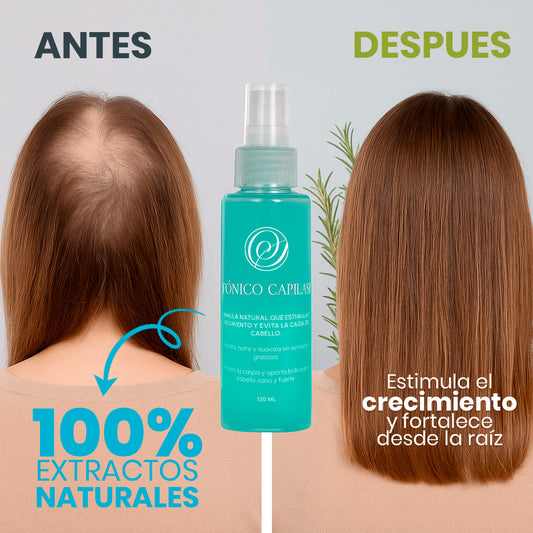 Tónico Capilar Anticaída y Anticaspa Natural SECRETOS